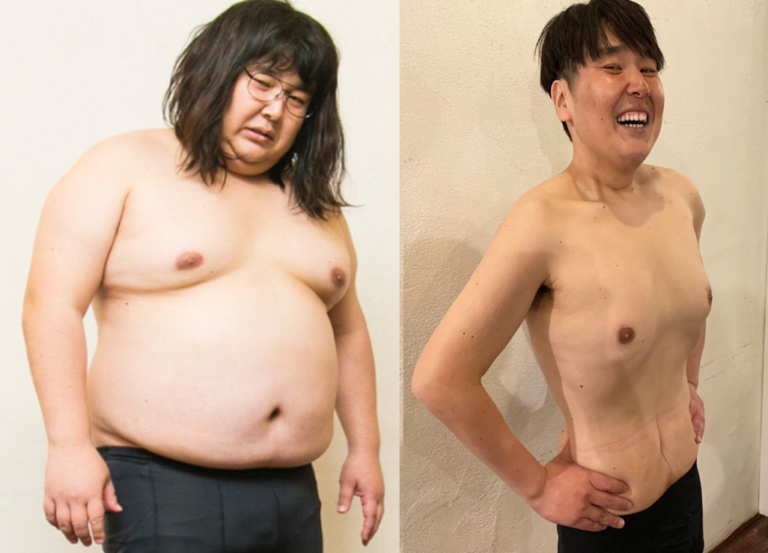 ガリガリガリクソンが痩せたダイエット方法｜体重47キロ減量で現在は激変